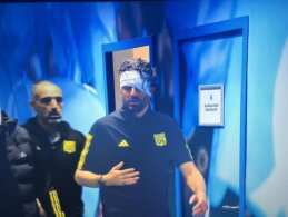 Spauda: „Lyon“ atleido trenerį F. Grosso