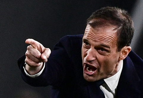 M.Allegri: mano kritikams reikėtų pasigydyti