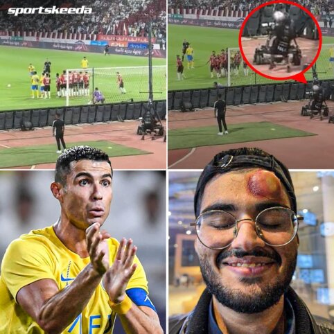 C. Ronaldo smūgio kamuoliu į operatorių pasekmės
